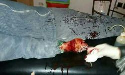 7 جرحى من المدنيين جراء قصف لقوات النظام على بلدتي مضايا وبقين